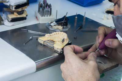 Dental professional checking a dental bridge