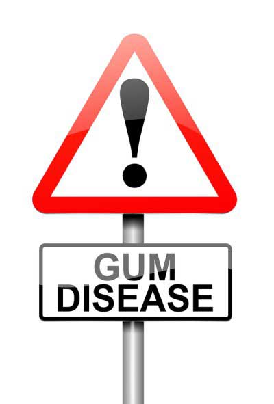 Gum disease