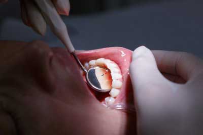 Dentist checking patient's teeth