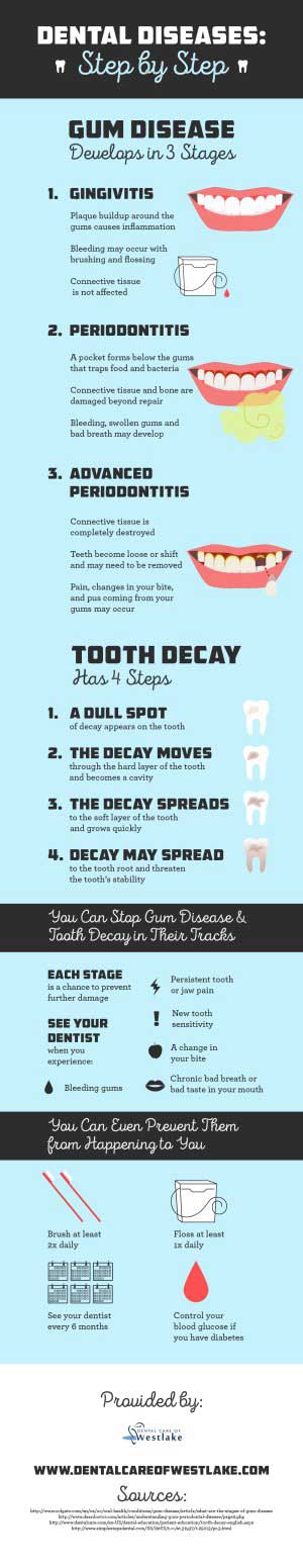 Dental Diseases-Step by Step-Infographic