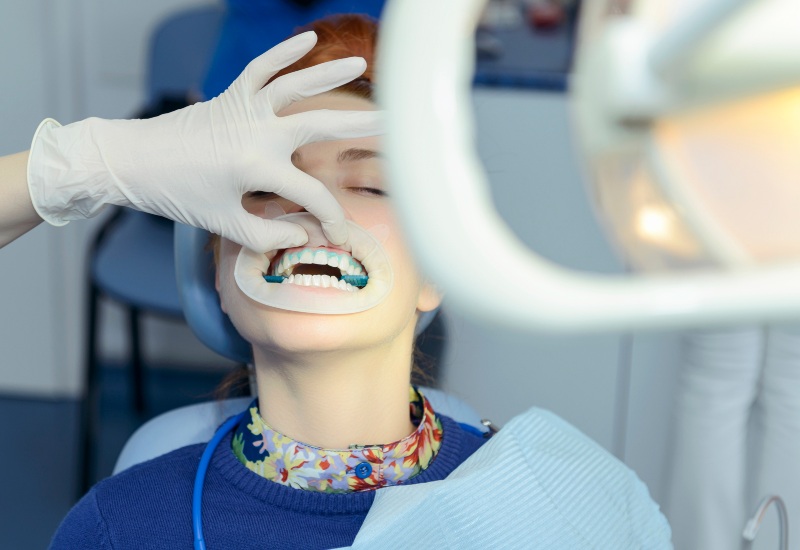 Patient receiving teeth whitening treatment at dental clinic in Westlake, OH