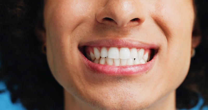 Smile with straight teeth after braces removal in Westlake, OH